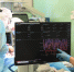 Врачи избавили жительницу Челябинска от гигантской груди - Южноуральская панорама